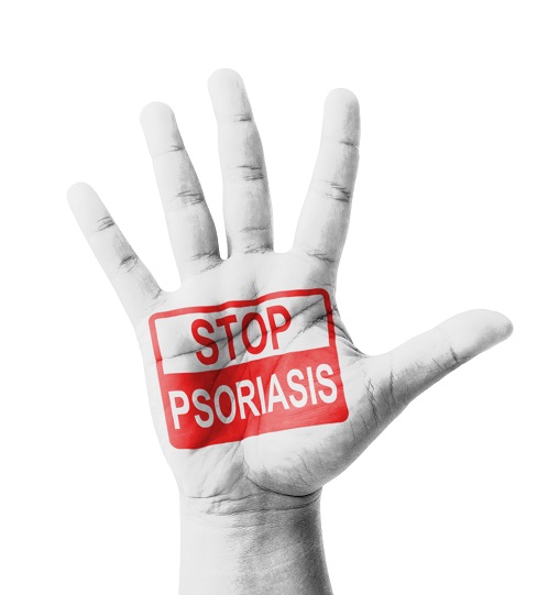 Psoriasis - peau